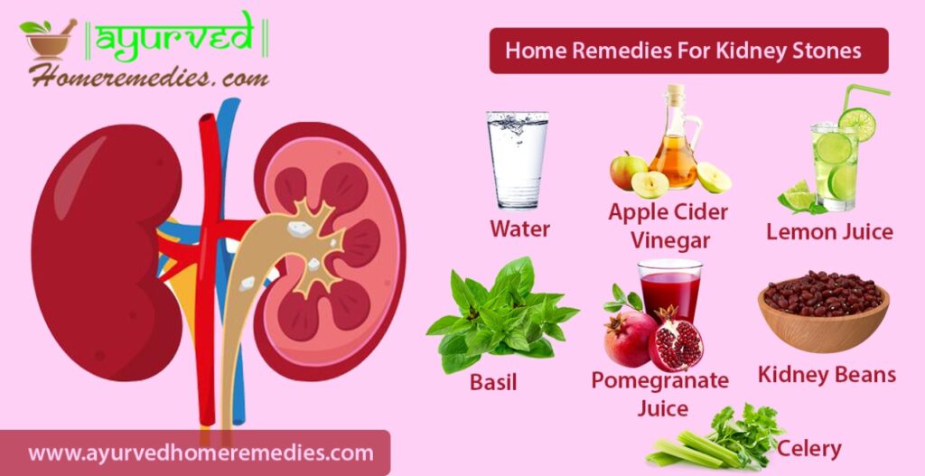 Home Remedies To Treat Kidney Stones How to Remove Kidney Stones