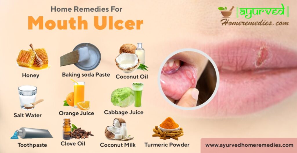 what-is-the-cause-of-mouth-ulcers-dental-care-tips