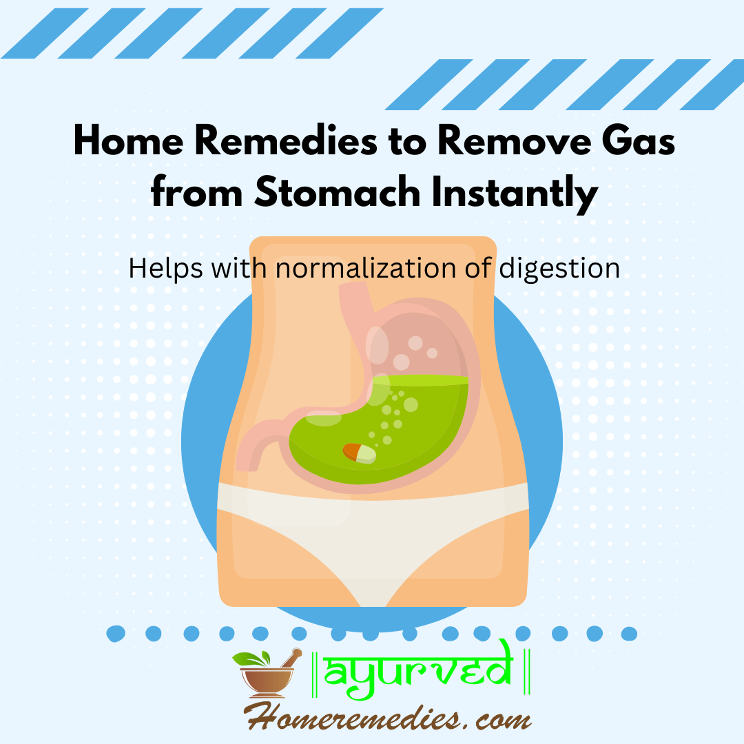 Top 10 Home Remedies To Remove Gas From Stomach Instantly Ayurved 